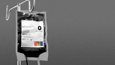 FDA moves to ease blood donor restrictions on gay men amid national shortage