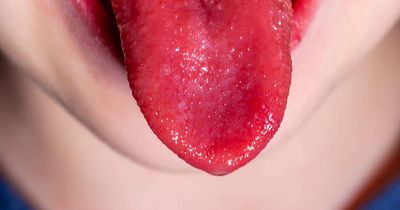 Heartbreak as fourth child in UK dies from Strep A bacterial infection