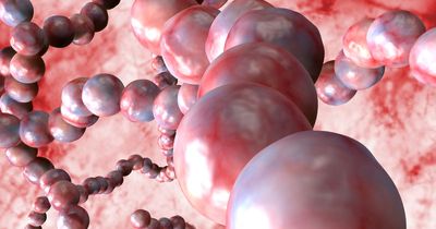 Strep A symptoms parents urged to look out for after infection causes child deaths
