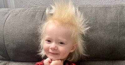 Girl, 3, with uncombable hair syndrome means she can't control her frizzy locks