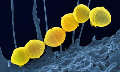 UK parents told to look out for signs of strep A in their children after six deaths
