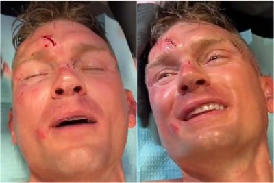 Video: Stephen Thompson gets stitched up in aftermath of UFC on ESPN 42 battle