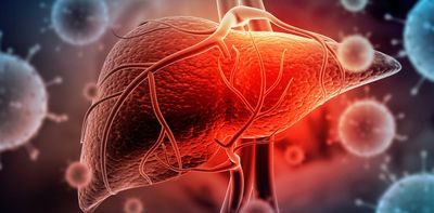 A liver disease drug could be repurposed to protect against COVID – new research