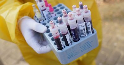 Blood test could detect Alzheimer's disease years before symptoms