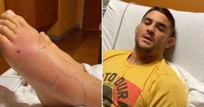 Dustin Poirier's foot almost doubles in size as UFC star battles serious infection