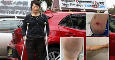 Airport arrest of alleged attacker of protester against Chinese government