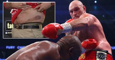 Tyson Fury shows off nasty bruise inflicted by Derek Chisora during trilogy win