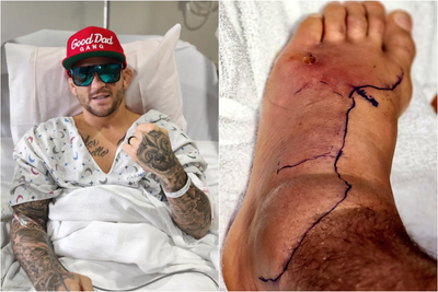 Dustin Poirier undergoes successful surgery on foot after infection causes readmission to hospital