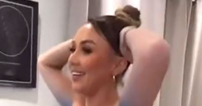 'My Christmas party outfit stained my skin bright blue - everyone called me a Smurf'