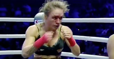 Bare-knuckle boxer who flashed crowd suffers gruesome injury in first loss
