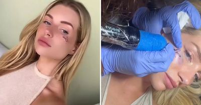 Lottie Moss wakes up with shock face tattoo after getting inked on boozy night