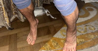 Conor McGregor touts 'Tour de France calves' as he shows off recovery progress