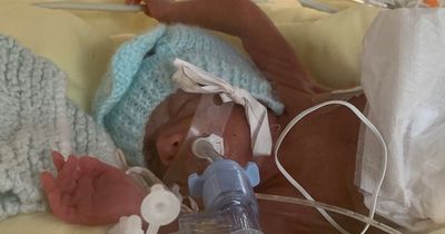 Baby born at 24 weeks was so small mum could 'see his heart beating through his chest'