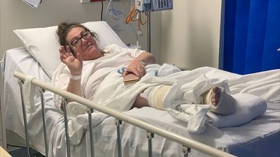 Melbourne grandmother worried she won't walk 'normally' again after 18-day wait for ankle surgery