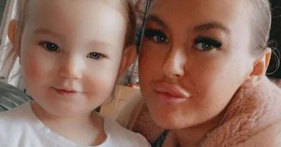 Mum who was suffering from headaches diagnosed with an incurable condition