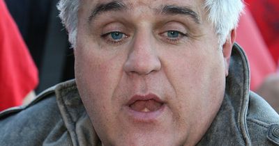 Jay Leno tells story of how his 'face caught on fire' during car garage accident
