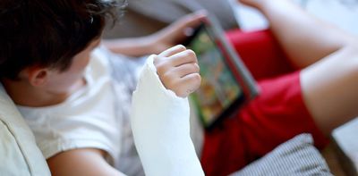 Breaking bones in childhood more than doubles the odds of it happening again as an adult, study finds