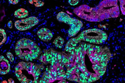 Study Reveals Cells Alter Themselves If Body Is Subjected To Starvation