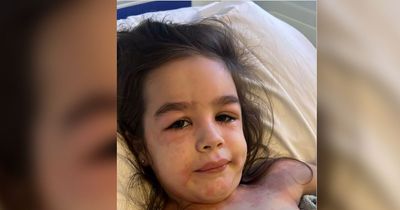 Mum's warning after daughter's rash turns out to be sign of Strep A