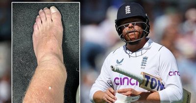 Jonny Bairstow struggling to make England return in New Zealand after horror leg break