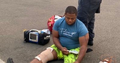 Dad snaps BOTH legs while bouncing on trampoline with kids after attempting flip