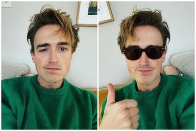 McFly’s Tom Fletcher reveals A&E dash over painful eye condition: ‘For now, it’s dark rooms and sunglasses’
