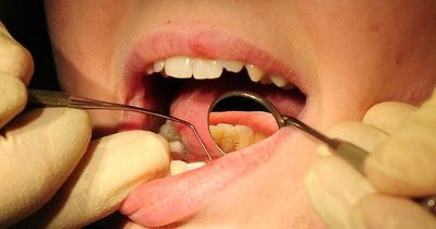 Waiting list to see an NHS dentist in Cardiff and Vale of Glamorgan tops more than 7,400