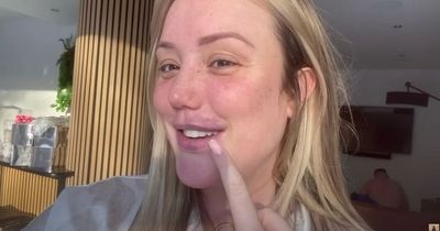 Charlotte Crosby praised by fans and told she 'looks so beautiful' after getting lip filler removed