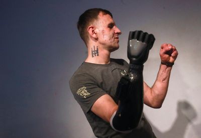 Ukrainian soldiers receive 'bionic' prostheses in Mexico