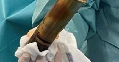 Man, 88, sparks hospital evacuation after arriving with WWI artillery shell in backside