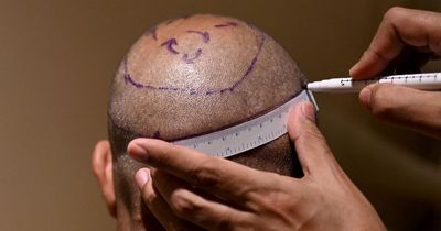 Brits heading to Turkey for new hair or teeth warned after 22 'medical tourism' deaths