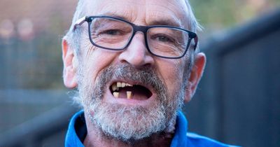 Man pulls his own teeth out with pliers and keeps them in jar after failing to get an NHS dentist