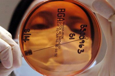 Scientists take first steps towards urine test for cancer