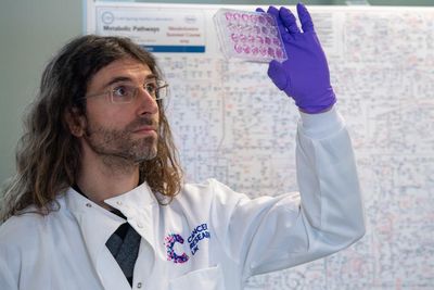 Glasgow scientists take steps towards world-first urine test for cancer