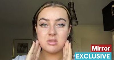 'I got buccal fat surgery but I'm warning people against blindly following this trend'