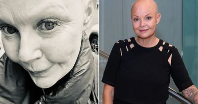 Gail Porter admits she feels 'insecure' about being bald as she gets new eyelashes