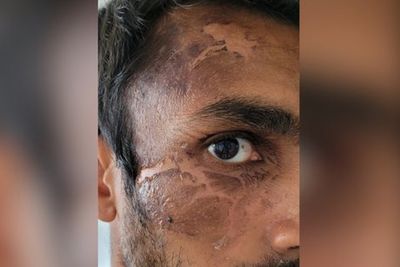 Racist thug who hurled boiling water at Ealing police officer avoids jail