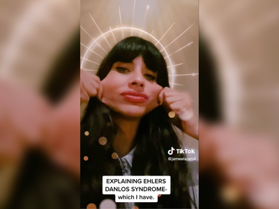‘Very sexy’: Jameela Jamil shows effects of her rare tissue disorder