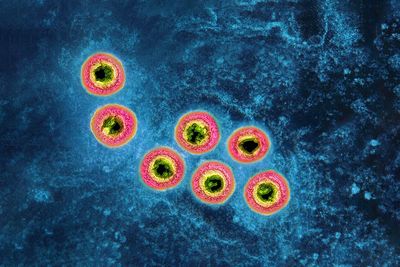 Tests start for herpes vaccine