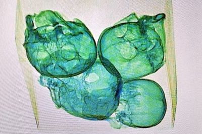 Four human skulls found at Mexico airport in package bound for US