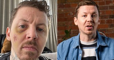 Professor Green nearly died after falling into 'steel and concrete' during seizure