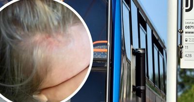 Mum claims daughter was 'kicked off bus' after being attacked by a group of girls