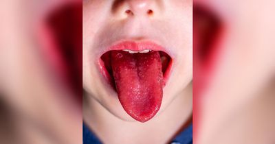 Warning to parents over Strep A as children return to school