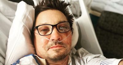 Jeremy Renner shares photo of bruised face and breaks silence after horror accident