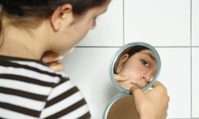 Children disliking how they look is a natural stage of growing up