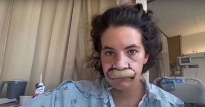 Model who had lip bit off in dog attack undergoes amazing transformation