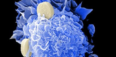 Nanomedicines for various diseases are in development – but research facilities produce vastly inconsistent results on how the body will react to them