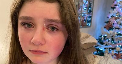 Dublin schoolgirl, 12, viciously attacked by group outside shopping centre over 'TikTok row'
