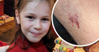 Eight-year-old girl injured by 'aggressive' dog attack while rollerskating