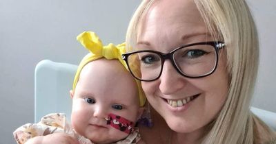 Mum noticed unusual change to her baby's head before devastating diagnosis